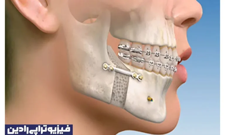 فیزیوتراپی فک و صورت