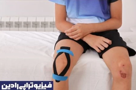 فیزیوتراپی زانو