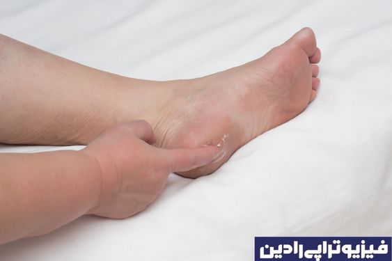 خار پاشنه