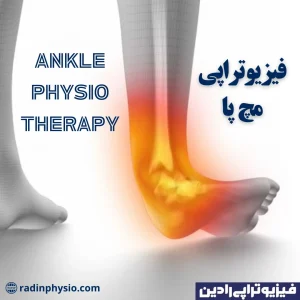 فیزیوتراپی مچ پا