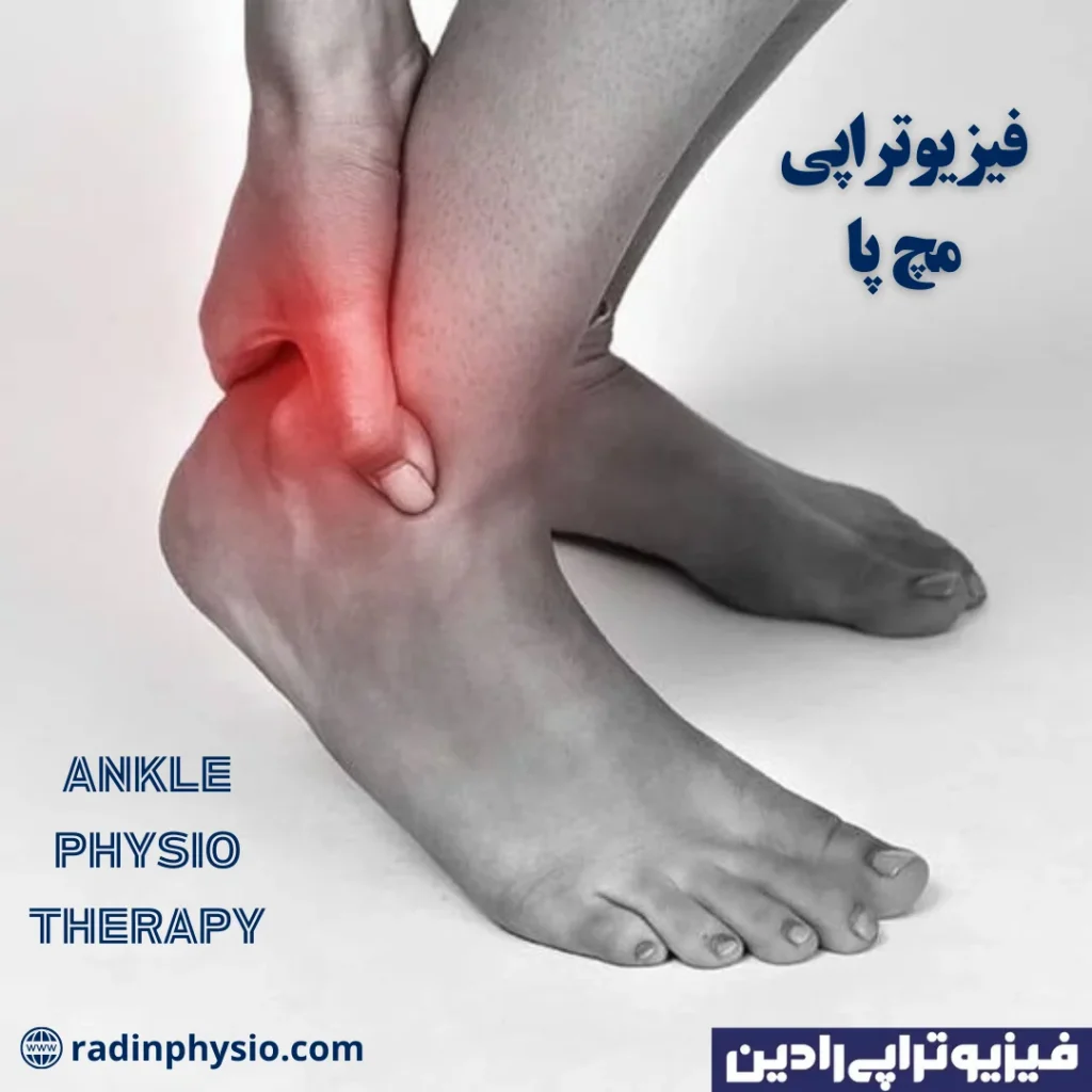 فیزیوتراپی مچ پا