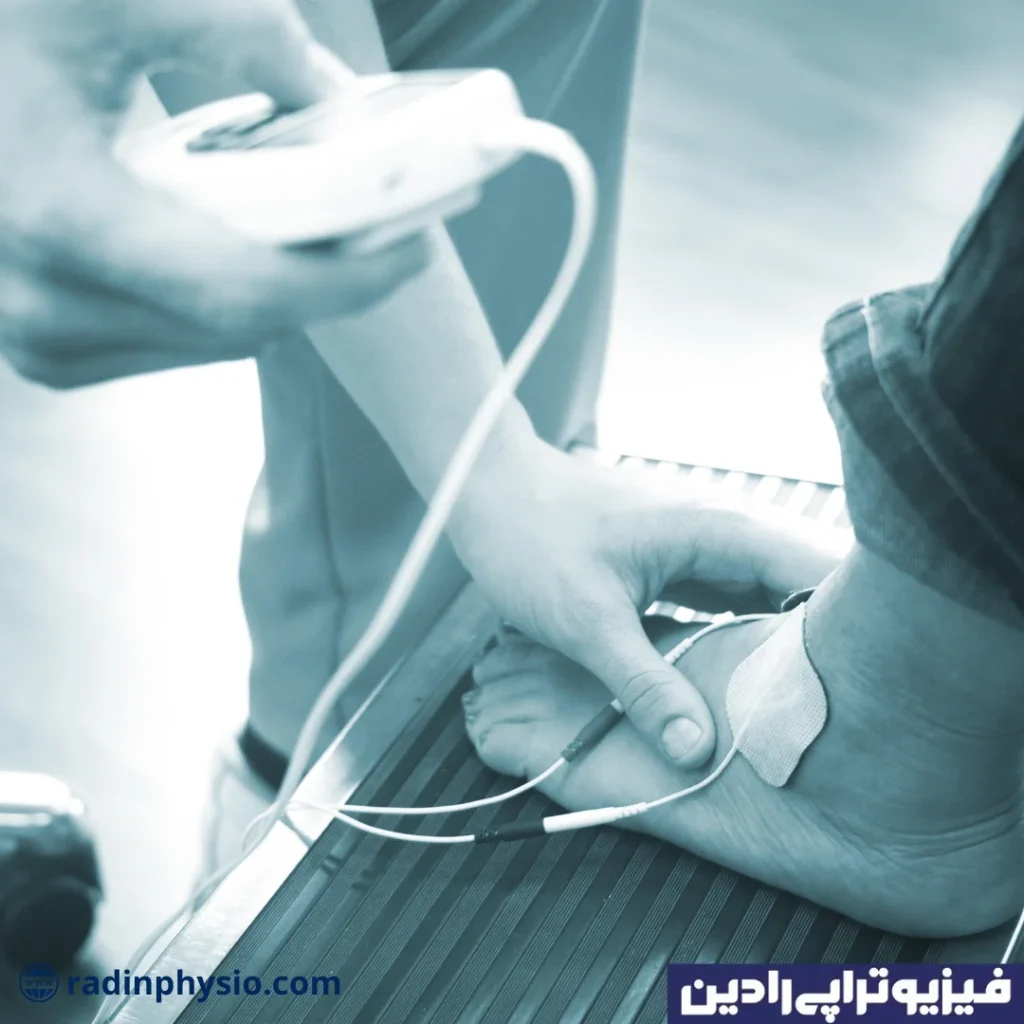 مچ پا درمان مچ پا 6