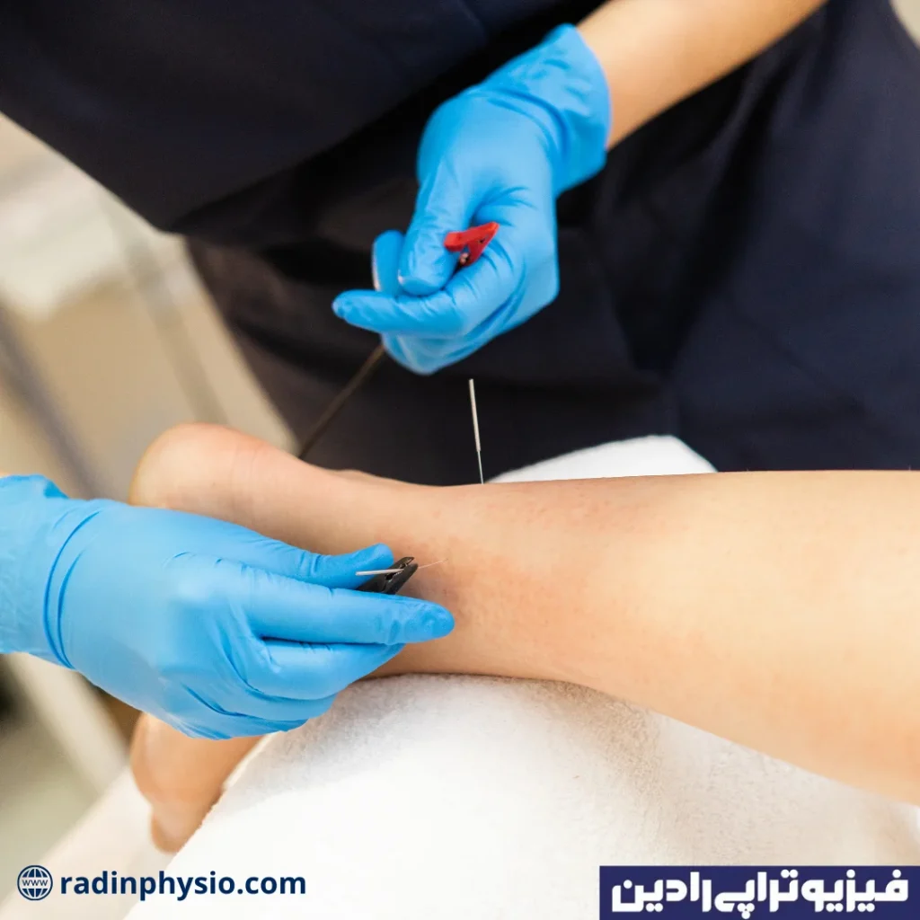 فیزیوتراپی مچ پا