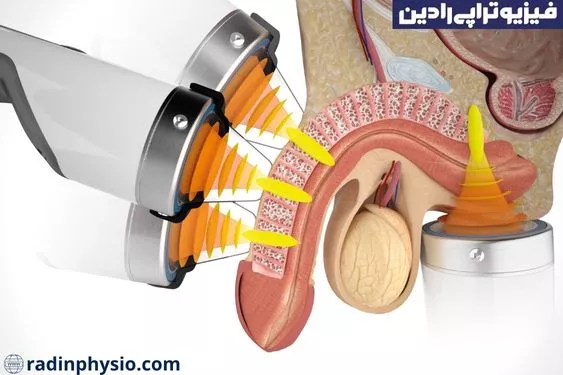 اختلالات نعوظ در مردان، اختلالات نعوظ