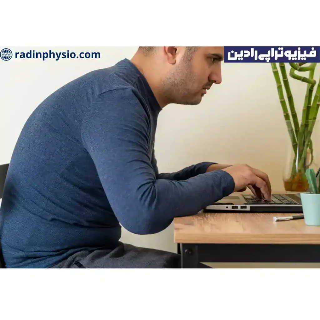 کیفوز