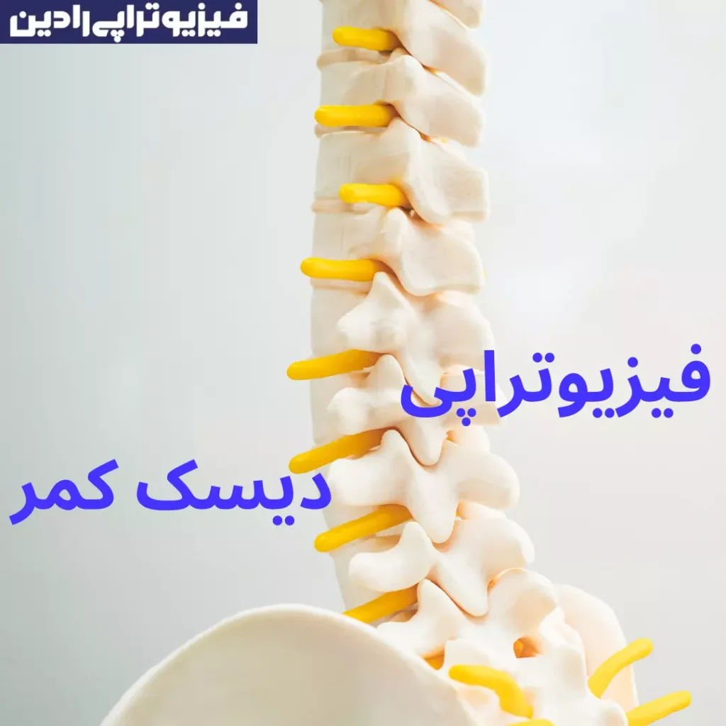 فیزیوتراپی دیسک کمر