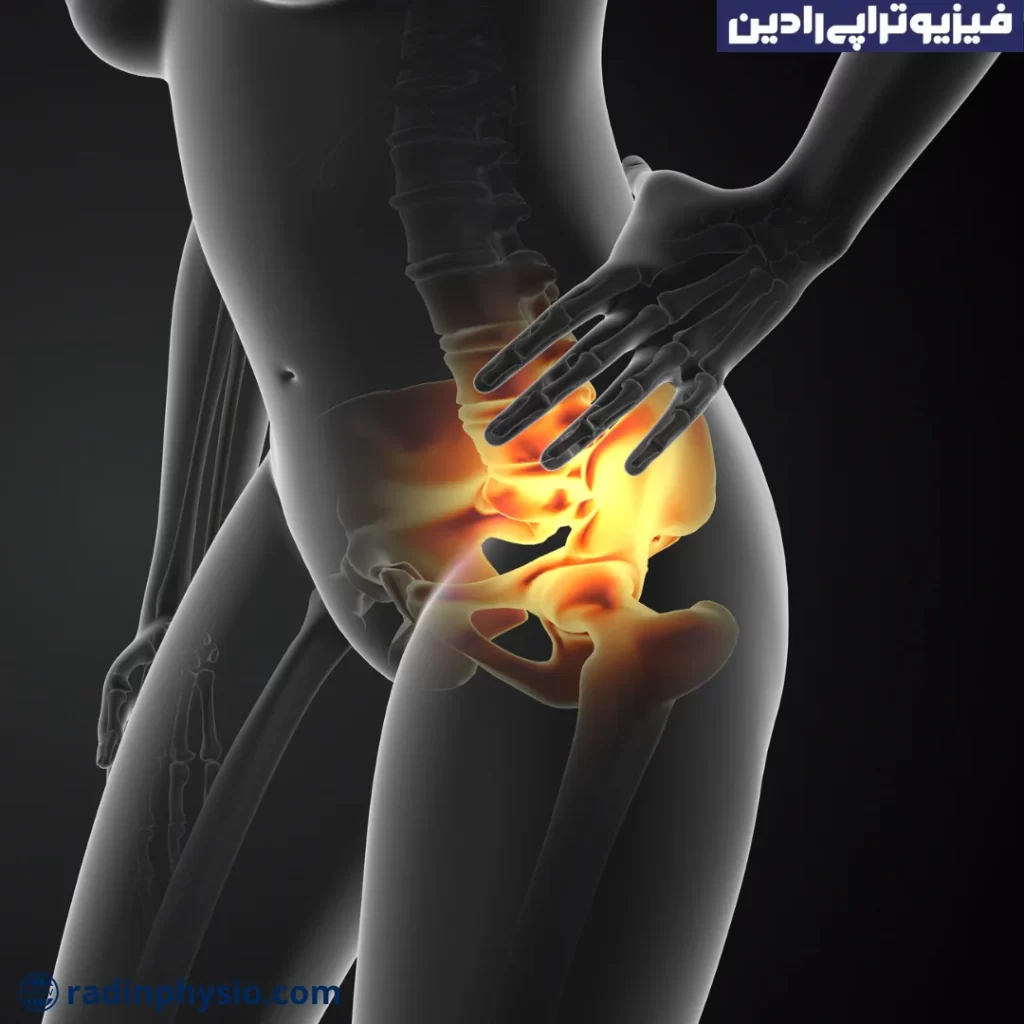 فیزیوتراپی کف لگن، ضرب دیدگی لگن