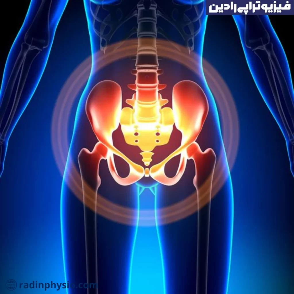 کف لگن فیزیوتراپی، درد کف لگن