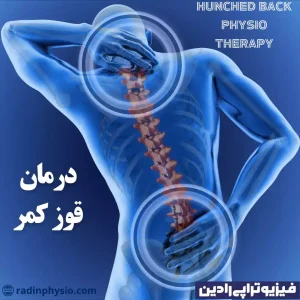 قوز کمر