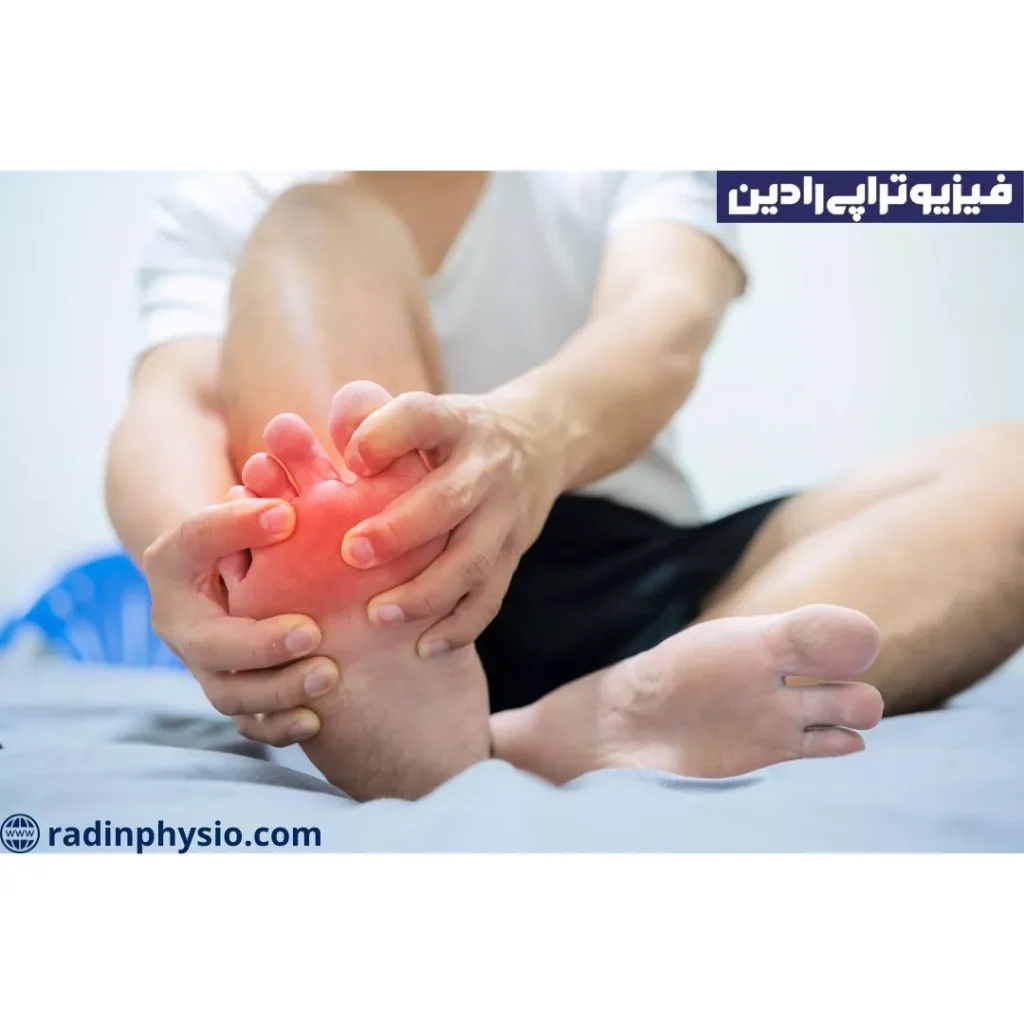 نقرس