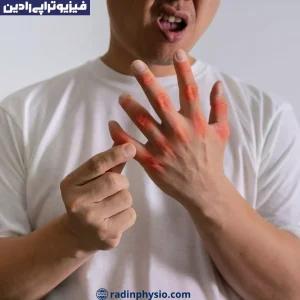 نقرس