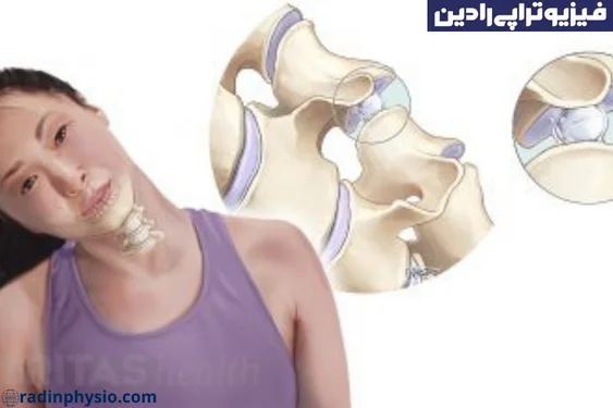 فیزیوتراپی صدای مفاصل یا کریپتوس (Crepitus)