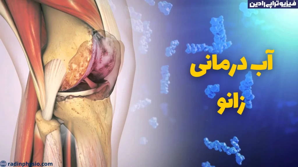 آب درمانی زانو تهران