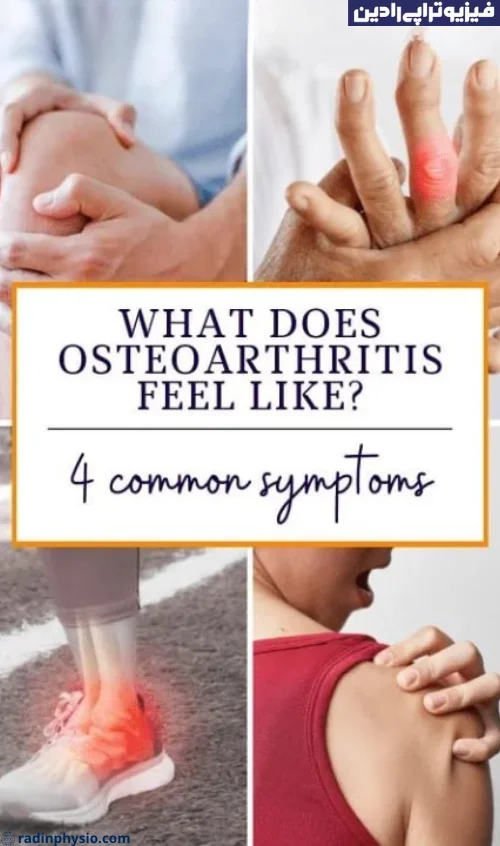 فیزیوتراپی آرتروز(Osteoarthritis) اولیه