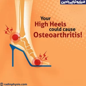 فیزیوتراپی آرتروز (Osteoarthritis)