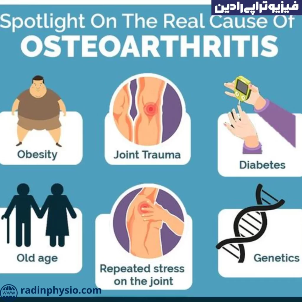 فیزیوتراپی آرتروز(Osteoarthritis) متابولیک