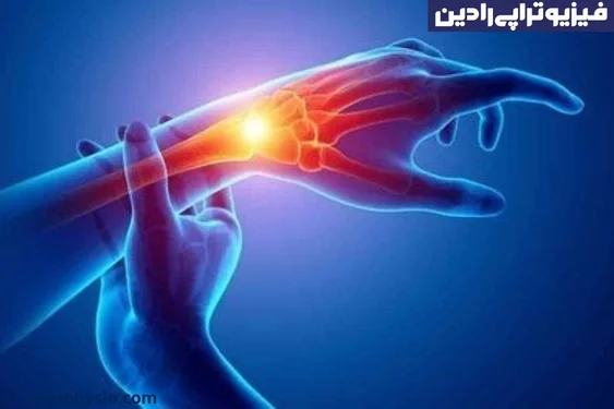 فیزیوتراپی آرتروز(Osteoarthritis) دست