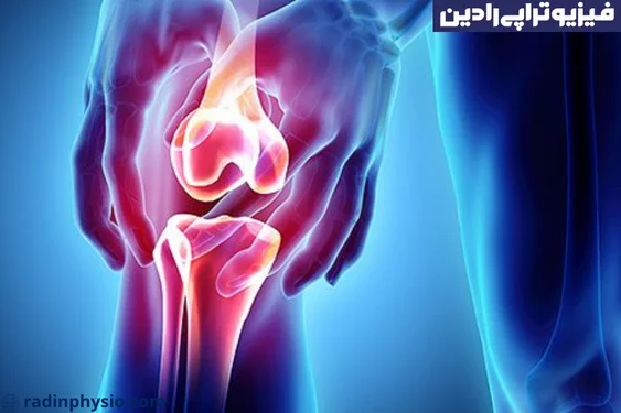 فیزیوتراپی استئونکروز زانو