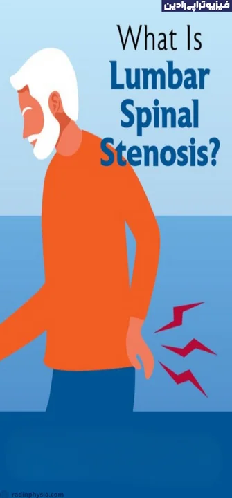 تنگی کانال نخاعی کمری (Lumbar spinal stenosis)