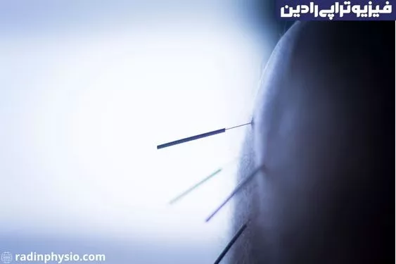 تکنیک ماشه ای