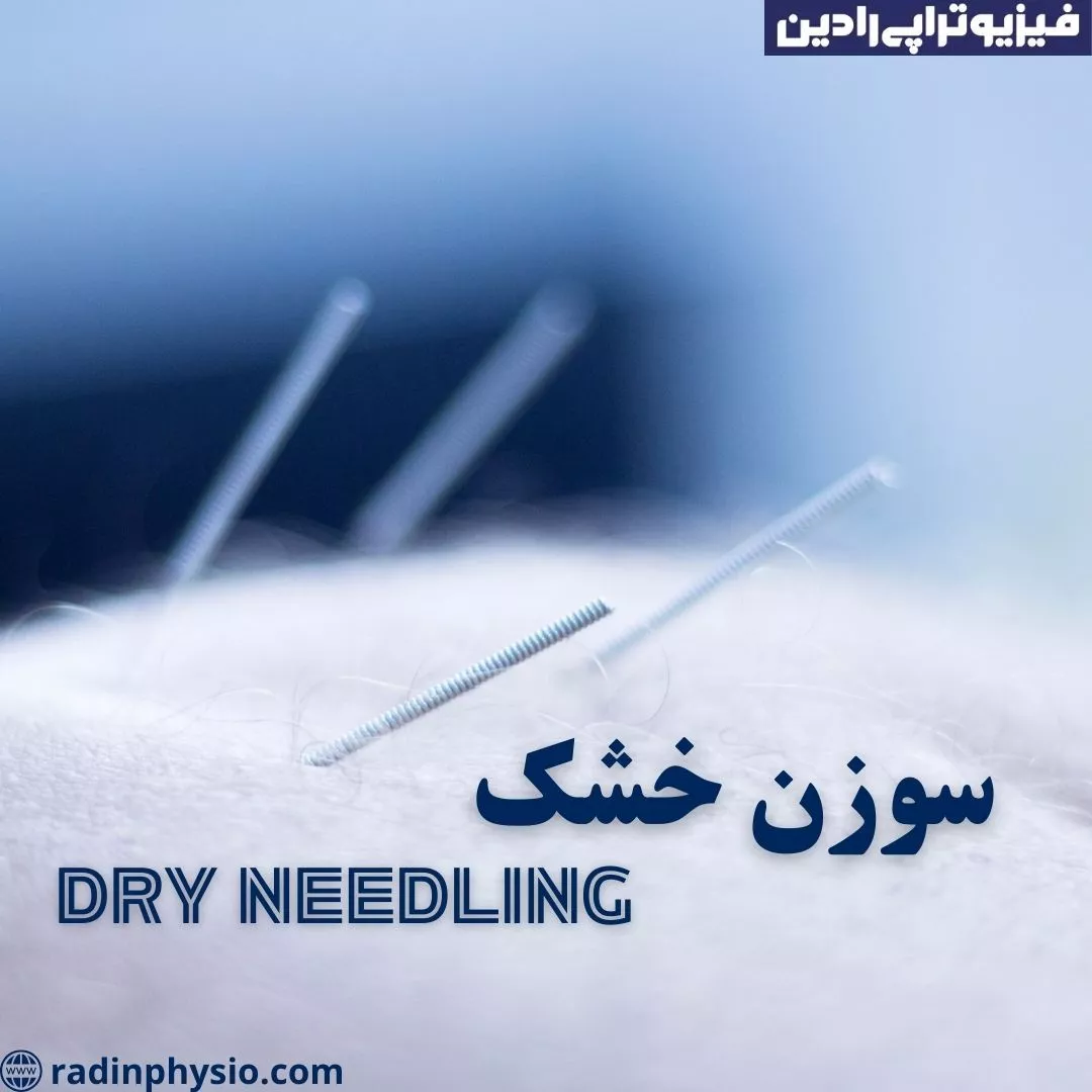 درای نیدلینگ