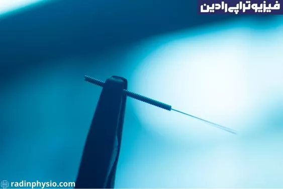 درای نیدلینگ تهران