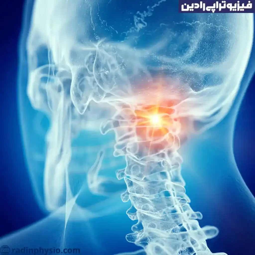 دیسک گردن