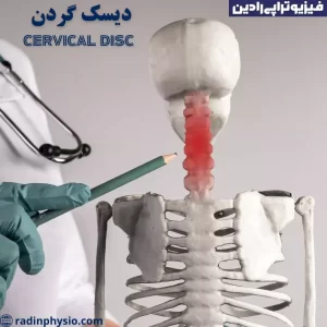 دیسک گردن