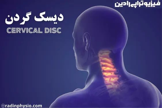 علائم دیسک گردن