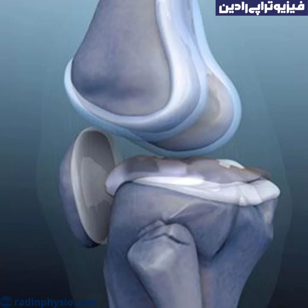 فیزیوتراپی صدای مفاصل یا کریپتوس (Crepitus)
