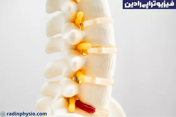 فیزیوتراپی دیسک کمر و گردن