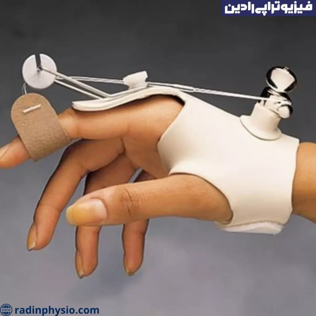 فیزیوتراپی مچ دست و عصب رادیال تهران