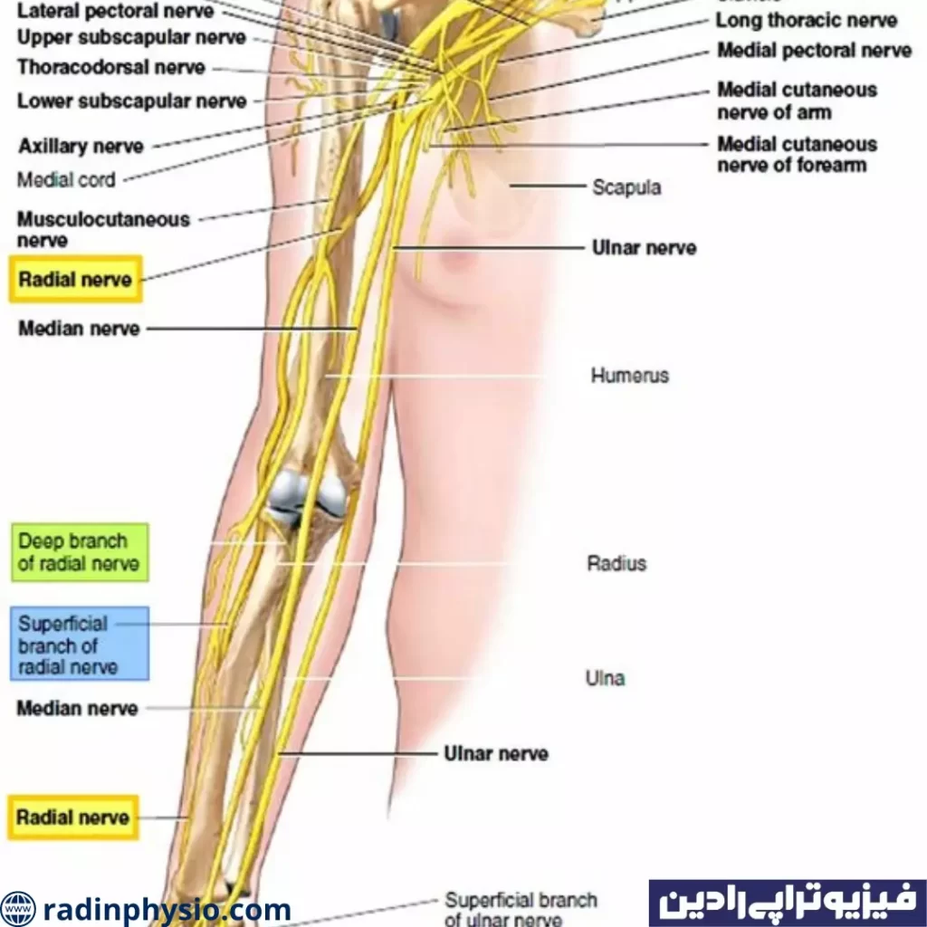 فیزیوتراپی افتادگی مچ دست و عصب رادیال تهران