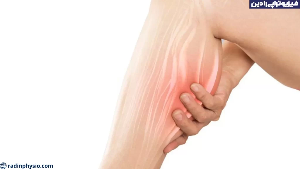 مگنت تراپی اسپاسم یا گرفتگی عضلات