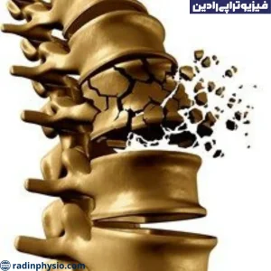 فیزیوتراپی نرمی استخوان