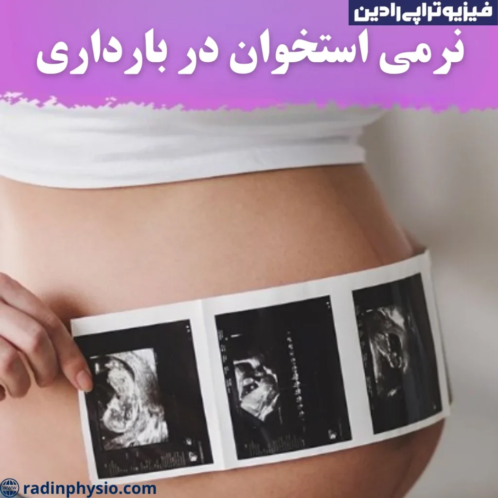 نرمی استخوان در بارداری