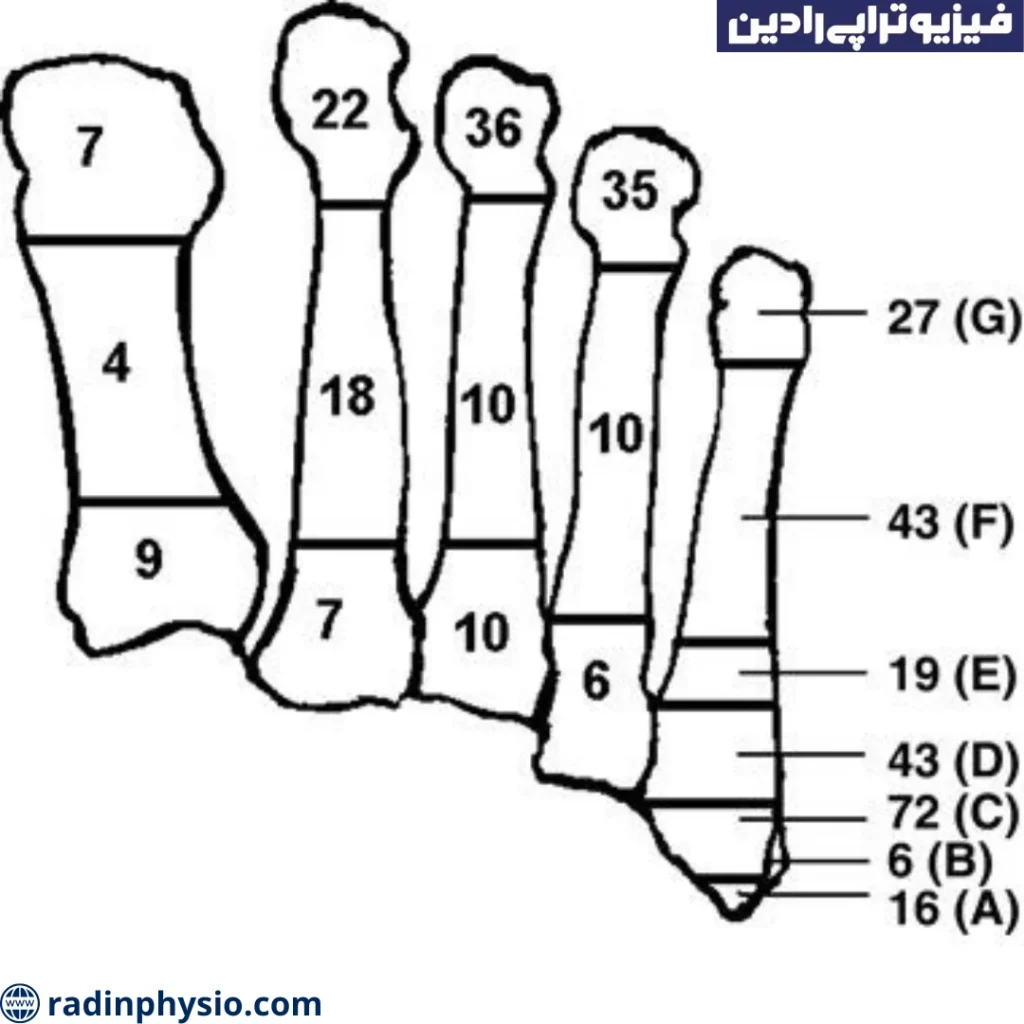 پوکی استخوان در زنان