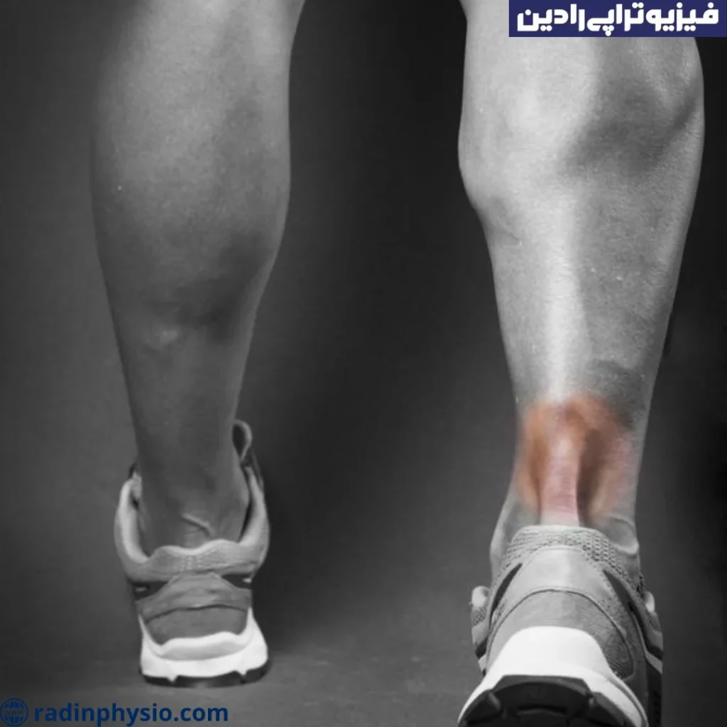 کوتاهی تاندون آشیل