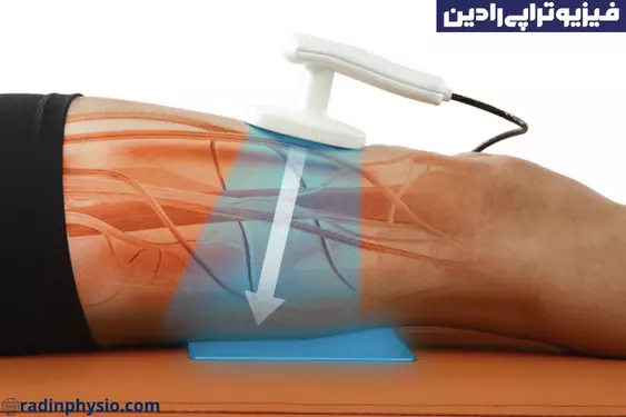 تکار تراپی