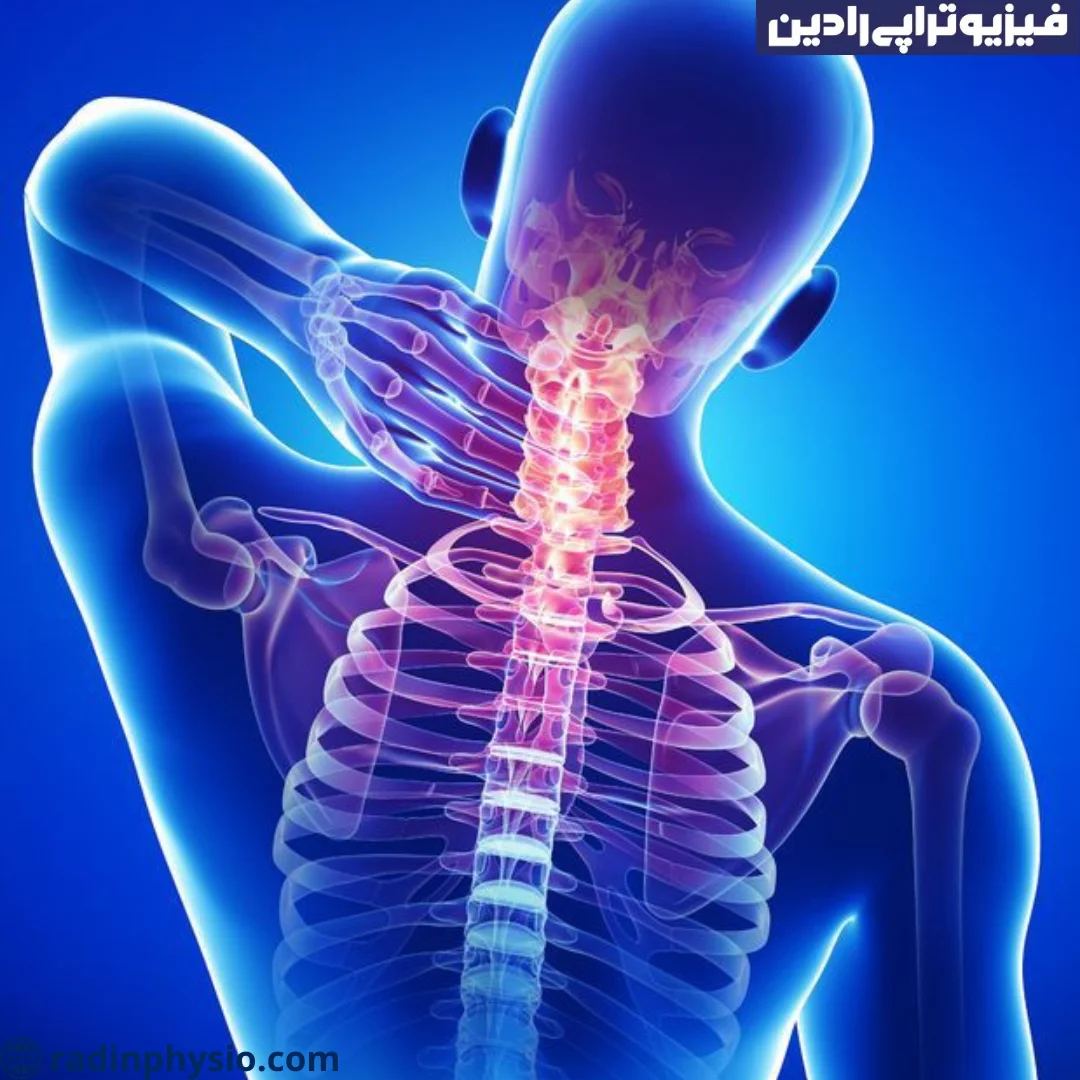 فیزیوتراپی گردن در منزل، در خانه