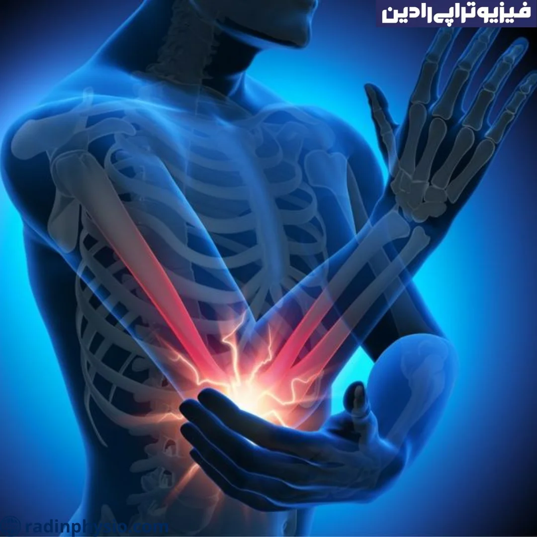 فیزیوتراپی آرنج در منزل، در خانه
