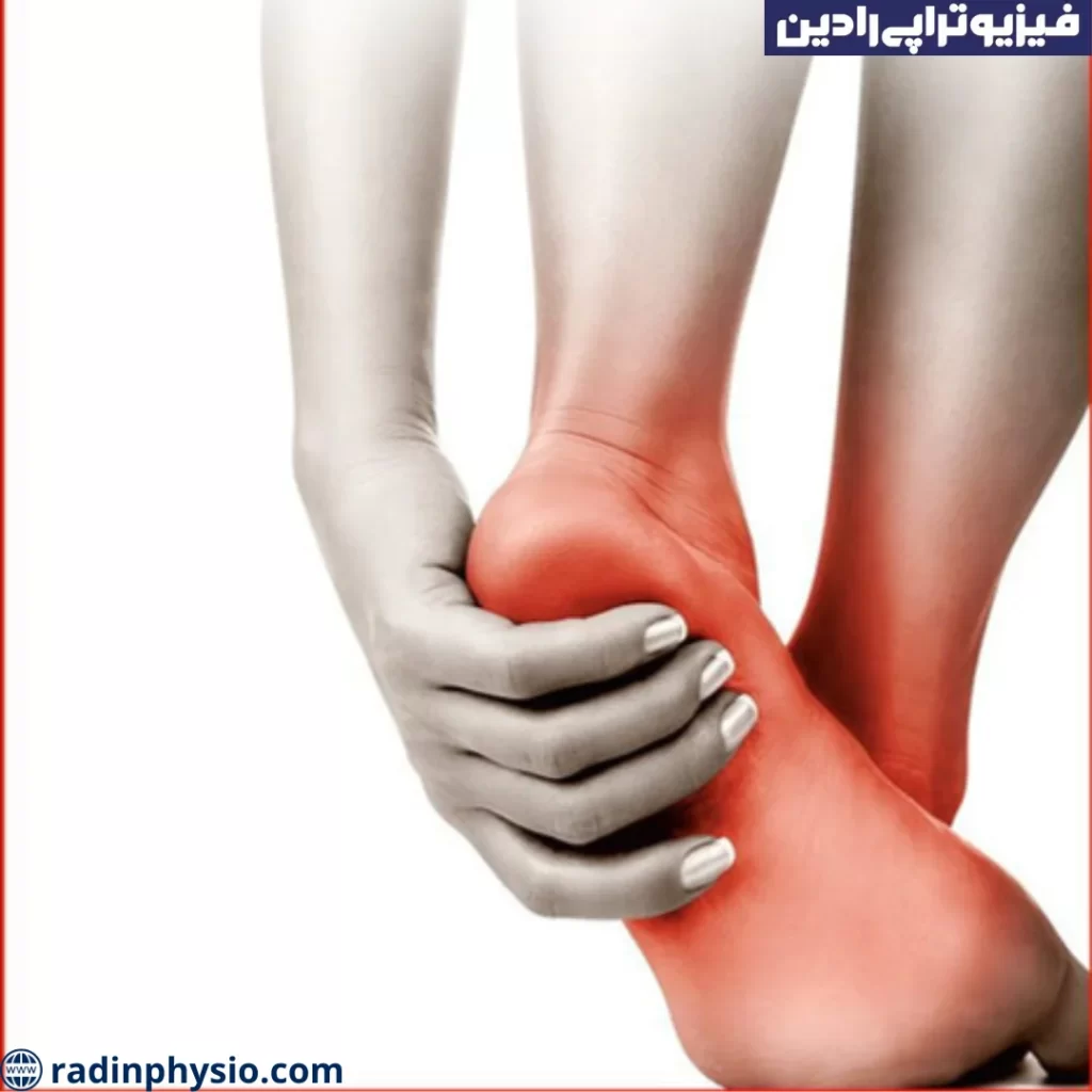 فیزیوتراپی جهت درمان داغی کف پا