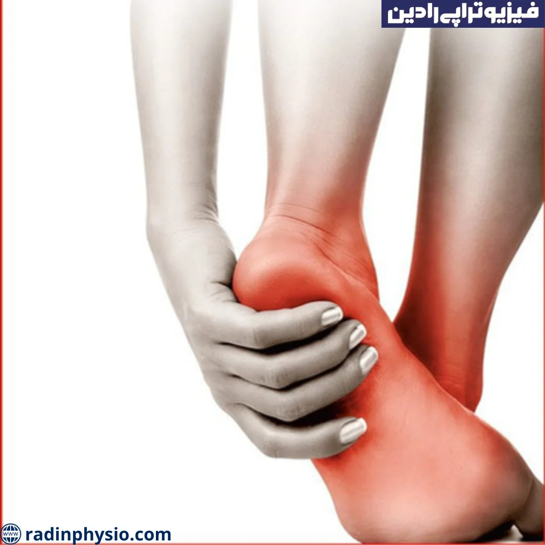 فیزیوتراپی جهت درمان داغی کف پا