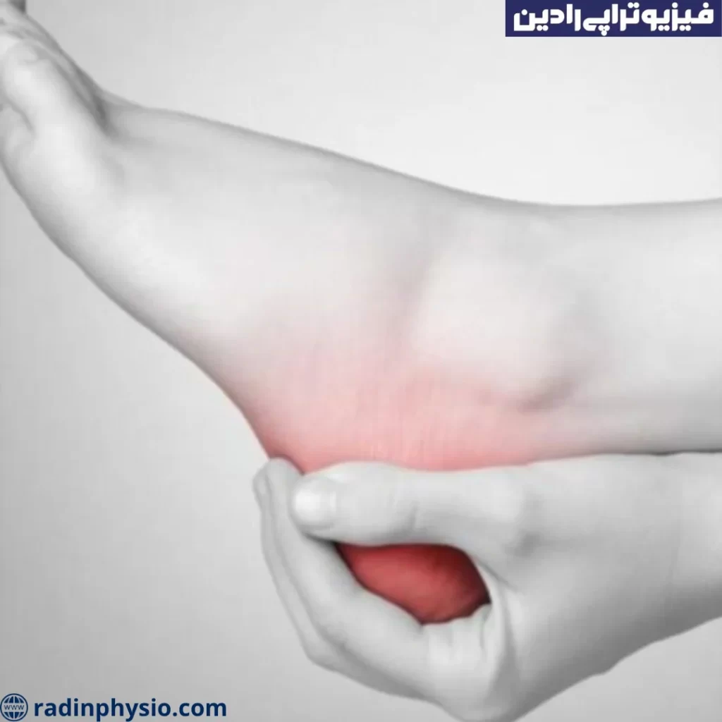 پیشگیری از داغ شدن کف پا
