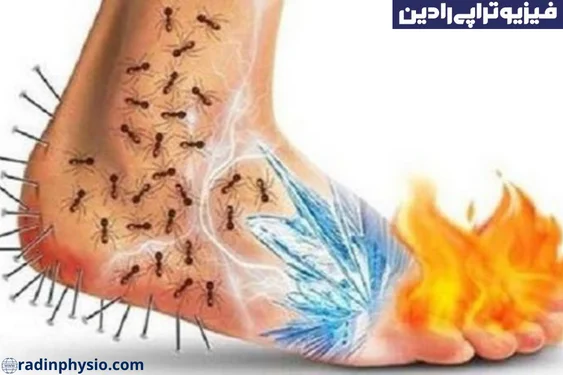 نوروپاتی پریفرال