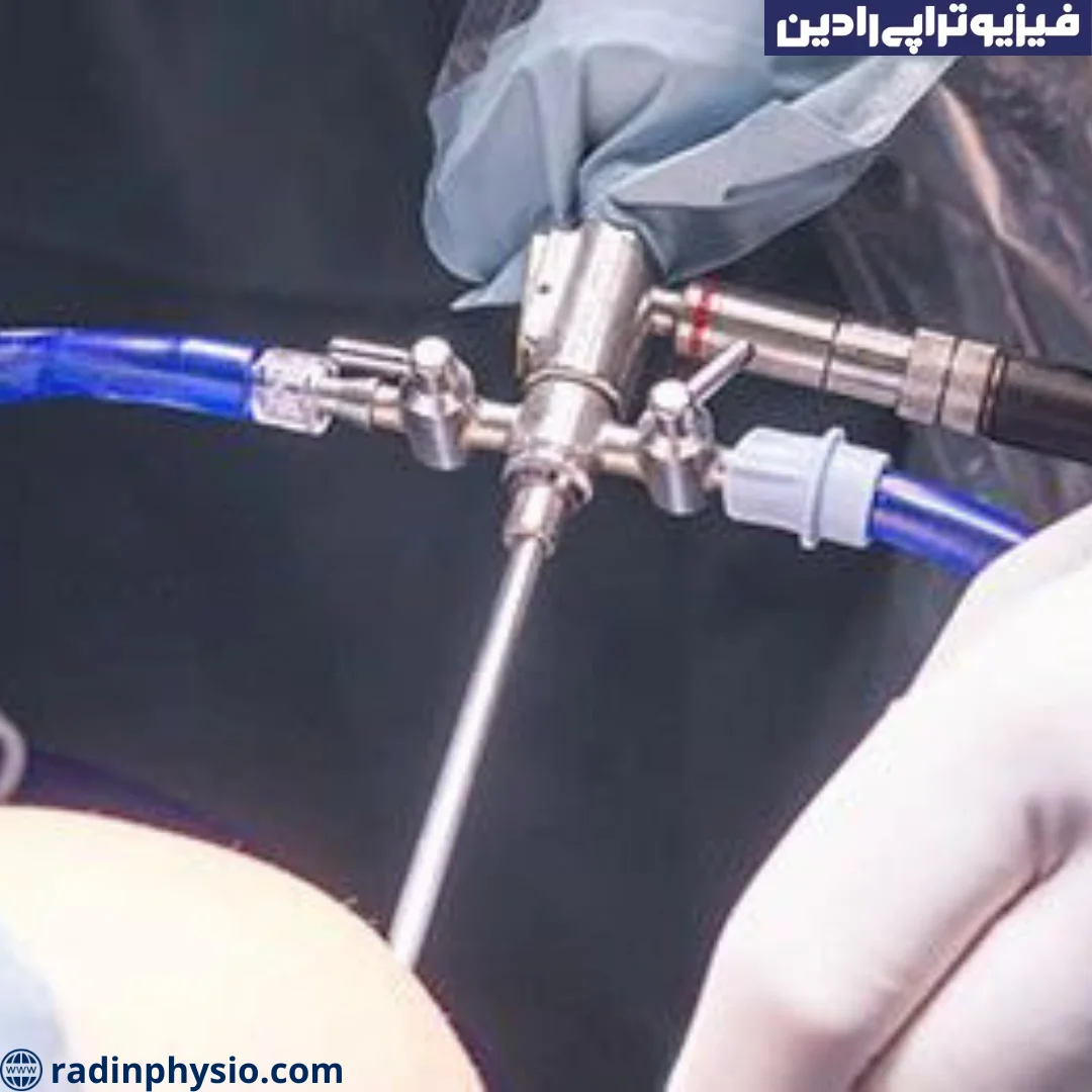 آرتروسکوپی مچ دست