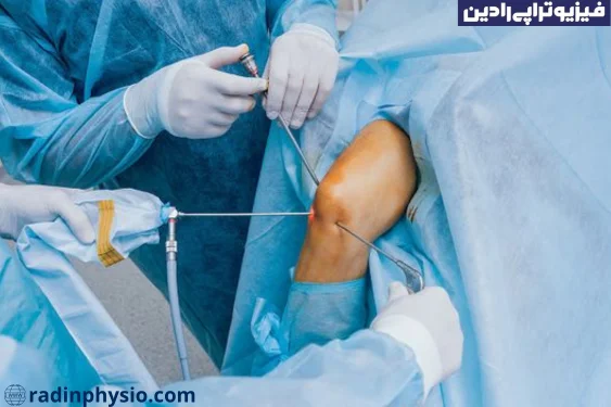 جراحی آرتروسکوپی