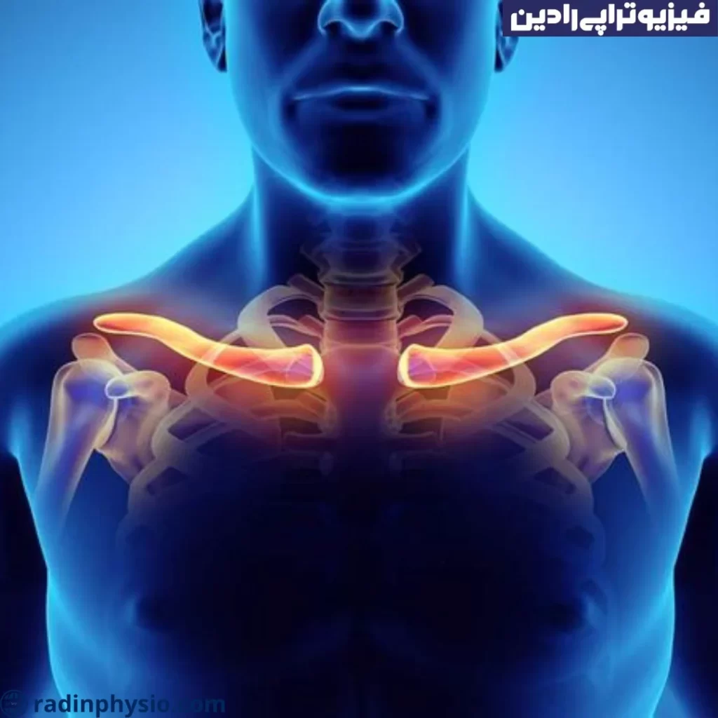 فیزیوتراپی شکستگی ترقوه