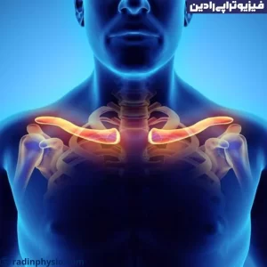 فیزیوتراپی شکستگی ترقوه