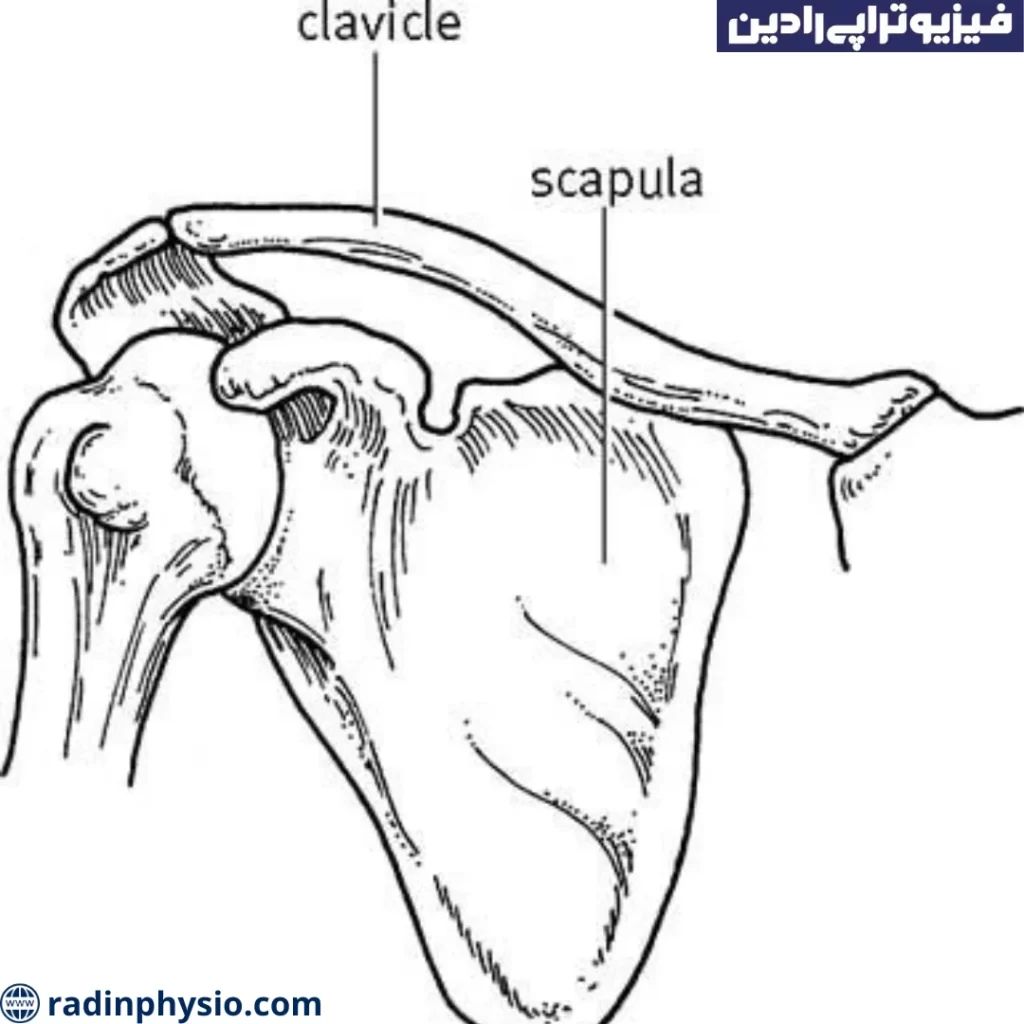 شکستگی ترقوه یا کلاویکل